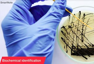 ¿Por qué la identificación manual de microorganismos es fundamental para todos los laboratorios de microbiología?